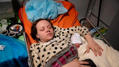 Mariana Vishegirskaya lies in a hospital bed after giving birth to her daughter Veronika in Mariupol, Ukraine, on Friday. AP