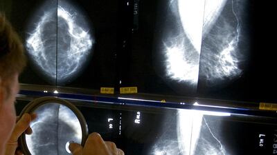 A radiologist uses a magnifying glass to check mammograms for breast cancer. Damian Dovarganes / AP
