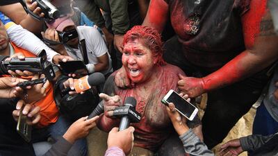 Mayor of Vinto, Patricia Arce, speaks to the media after being attacked in the street by a crowd that sprayed her with reddish paint and cut her hair in Vinto, Bolivia. EPA