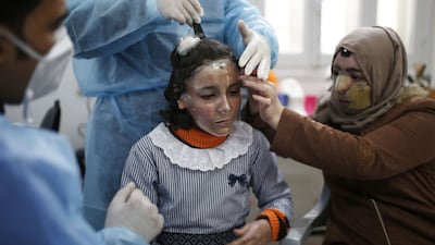 Palestinian Maram Al Amawi, suffering from severe facial burns, is fitted with a 3D-printed transparent face mask at a clinic run by Doctors Without Borders (MSF) in Gaza city on February 22, 2021. AFP