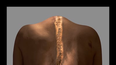 Vivan Sundaram's final exhibition is on display at Sharjah Biennal; it includes Six Stations of a Life Pursued: Suture, Untitled, II (2018). All photos: Vivan Sundaram and Photoink