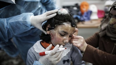 Maram and her mother Izdihar Al Amawi suffered from severe facial burns in a bakery fire in April, 2020. AFP