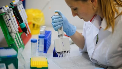 epa08600510 A handout photo made available by the Russian Direct Investment Fund (RDIF) shows a scientist of Nikolai Gamaleya National Center of Epidemiology and Microbiology working on the production of a new two-vector COVID-19 vaccine in Moscow, Russia, 06 August 2020 (issued 13 August 2020). Russia registered the new called Sputnik V vaccine against the coronavirus Sars-Cov-2 and opens the stage of its massive testing. EPA/RDIF HANDOUT NO RESTRICTIONS, ALLOW TO USE IN SOCIAL NETWORK HANDOUT EDITORIAL USE ONLY/NO SALES