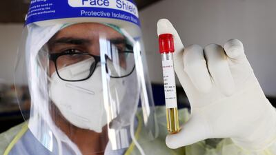 Palestinian medical staff collecting swab samples for Covid-19 testing in the coronavirus section of Dhahria hospital.EPA
