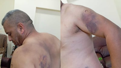 Pictures taken of Abu Hassan after he was abused by settlers in October 2023. Photo: Abu Hassan