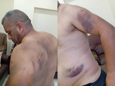 Pictures taken of Abu Hassan after he was abused by settlers in October 2023. Photo: Abu Hassan