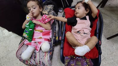 Gazan sisters Misk, right, who is 18 months old, and Hanan, 3, lost their mother and limbs in an Israeli air attack, and now live with an aunt. Photo: Osama Al Kahlout