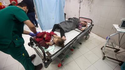 Palestinian children receive medical attention at Nasser Hospital in Khan Younis in the southern Gaza Strip. AFP