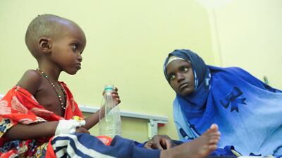 Jamila Omar, 3, and her mother Amina Mohamed in Banadir Hospital in Mogadishu, Somalia.