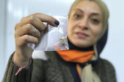 Dr Gihan Kamel holds up a 4,000 year-old tooth she is studying at Sesame. Salah Malkawi for The National
