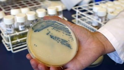 A petri dish with methicillin-resistant Staphylococcus aureus (MRSA). Incidences of the superbug are on the rise in the UAE.