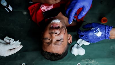 A child, who was airlifted from Rasuwa district, receives first-aid at a mobile hospital inside the Maithali Barrack, an army training centre, which also serves as a primary base to airlift survivors following flash floods and mudslide at Trishuli in Nuwakot district, Nepal. Reuters
