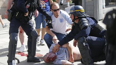 A man injured in clashes is assisted by police officers in downtown Marseille, France. Riot police have thrown tear gas canisters at soccer fans in Marseille’s Old Port in a third straight day of violence in the city. Darko Bandic / AP