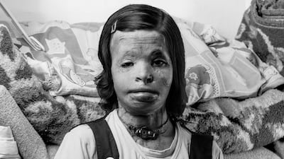 Deniz Calagan / International Medical Corps UK