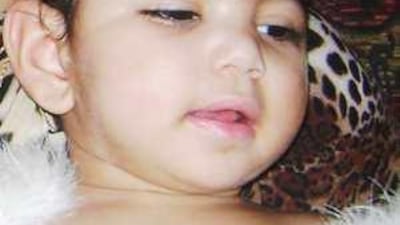 Ola Aljabri was left severely disabled after her birth