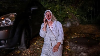 An injured woman kneels at the site of an apartment building hit by a Russian missile strike in Kyiv, Ukraine. Reuters