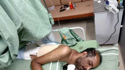 Noufal Kizekkethil spent nearly three months in hospital. Courtesy Noufal Kizekkethil