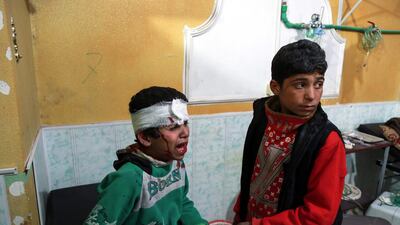 A bandaged Syrian child cries as he sits in a clinic in the rebel-held town of Douma, in the besieged Eastern Ghouta region yesterday. AFP