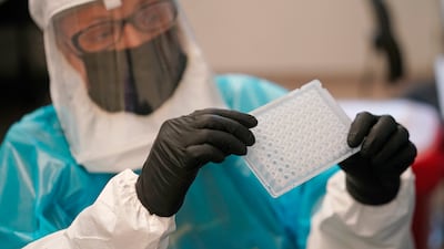 The WHO says more monkey-pox related deaths are likely after fatalities were reported in Brazil and Spain. AP