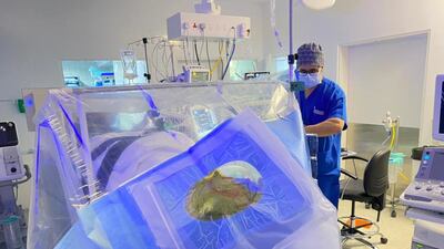Surgeons at Tawam Hospital perform the surgery.