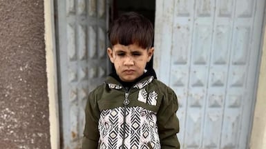 Adam Abu Halib, five, lost vision in his right eye after being crushed under rubble when an Israeli strike destroyed his family's home. Photo: Abu Halib family