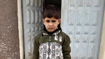 Adam Abu Halib, five, lost vision in his right eye after being crushed under rubble when an Israeli strike destroyed his family's home