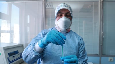 A Turkish Health Ministry employee displays materials for a rapid test kit for coronavirus at a laboratory in Ankara, Turkey. Reuters