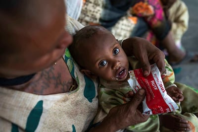 A woman holds her one year-old son, who is suffering from malnutrition at a health centre in Agbe, Ethiopia on June 7, 2021. Unicef via AP