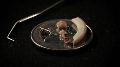 The tooth that gave away the proto-hummus dango’s long secret existence is the one in the top middle of the dirham coin, above. Courtesy Faysal Bibi