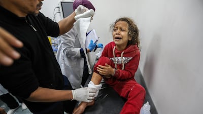 A Palestinian child wounded in Israeli air strikes arrives at Kuwait Hospital for treatment last month in Rafah, Gaza. Getty Images
