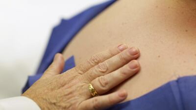 Western expatriates are being warned to take precautions when venturing out under the harsh UAE sun. Getty Images / AFP