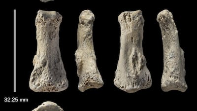 This photo provided by Michael Petraglia shows six different views of a Homo sapiens fossil finger bone from the Al Wusta archaeological site in Saudi Arabia. Researchers say the bone provides a new clue about when and how our species migrated out of Africa, with hunter-gatherers reaching the Saudi Arabia area by 85,000 years ago. Ian Cartwright /Michael Petraglia via AP Photo