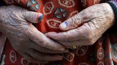 A Nepalese woman has her thumb inked after voting in parliamentary elections in Kathmandu. EPA