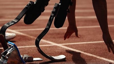 Oscar Pistorius admits 'everybody is entitled to their opinion', but 'doesn't like being called, in essence, a cheat'.