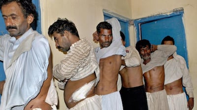 Pakistani citizens, who sold their kidneys for money, show scars at a police station in Lahore. KM Chaudary / AP Photo