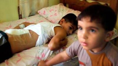 Moqtada, 13, went outside for fireworks after a victory by Iraq's football team but instead ended up with a bullet lodged in his back.