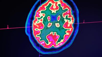 It’s time for everyone to embrace what experts have been repeating for years: there is no health without brain health. Fred Tanneau / AFP