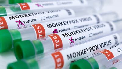 Test tubes labelled "Monkeypox virus positive and negative". Reuters