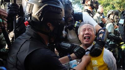 Richard Chan, a candidate for the district council elections, reacts after being pepper-sprayed by police in Hong Kong. AP Photo