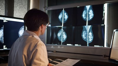 Detecting breast cancer early gives a patient an almost 99 per cent chance of being cured and reduces the likelihood of death by nearly 40 per cent. Getty
