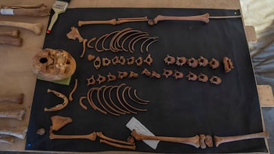 Ancient skull and bones are on display that Egyptian archaeologist Zahi Hawass and his team unearthed in a vast necropolis filled with burial shafts, coffins and mummies dating back to the New Kingdom 3000 BC in Saqqara, south of Cairo, Egypt. AP