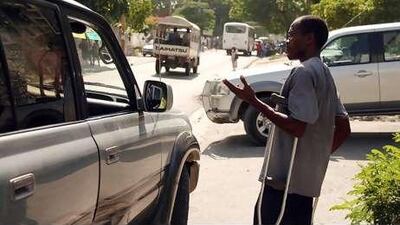 Pierre Louis Luckner's leg was crushed under a collapsing wall when the earthquake struck.
