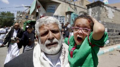 An injured girl reacts as she is carried out of a mosque which was attacked by a suicide bomber in the Yemeni capital of Sanaa on March 20, 2015. Khaled Abdullah/Reuters