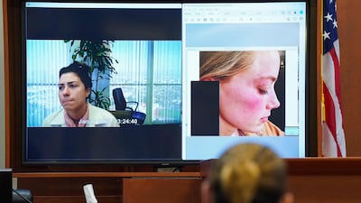 Pennington testifies she once lived in the Los Angeles penthouses with Depp and Heard, and on 'many occasions' documented physical injuries to the actress. AFP