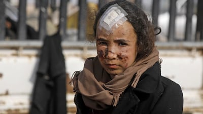 A wounded girl fleeing the ISIS holdout of Baghouz stands in a field in February 2019, during an operation by the US-backed SDF to drive out the militants from the eastern Syrian province of Deir Ezzor. AFP
