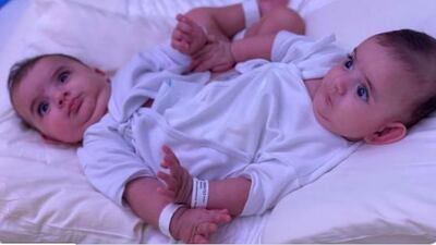 Ahmed and Mohammed before the operation on Thursday. Courtesy King Salman Center for Relief and Humanitarian Action