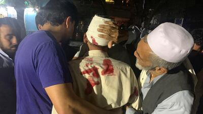 Afghan men carry an injured man in the hospital after a large explosion in Kabul, Afghanistan, Monday, September 2, 2019. AP Photo/Rahmat Gul