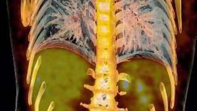 The information age: Medical technology can now show breathing lungs, and more - if the price is right.