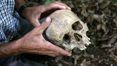 Srebrenica genocide survivor Ramiz Nukic looks at a skull that he found in the forest near Konjevic Polje, Bosnia and Herzegovina July 6, 2020. Nukic has made himself a promise, he will search for the remains of the people who went missing until the last of them is found. Reuters