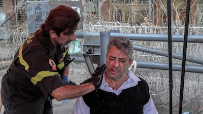 An injured protester receives medical aid after a scuffle with Hezbollah supporters. EPA